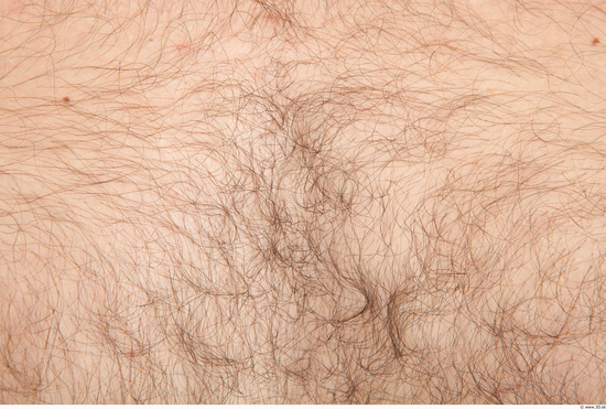 Hairy Skins