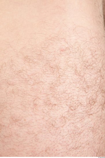 Hairy Skins