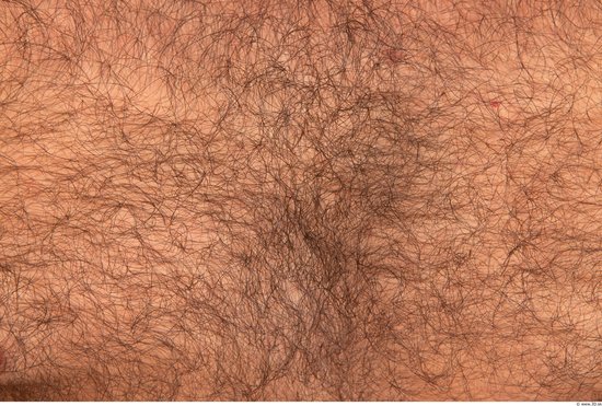 Hairy Skins