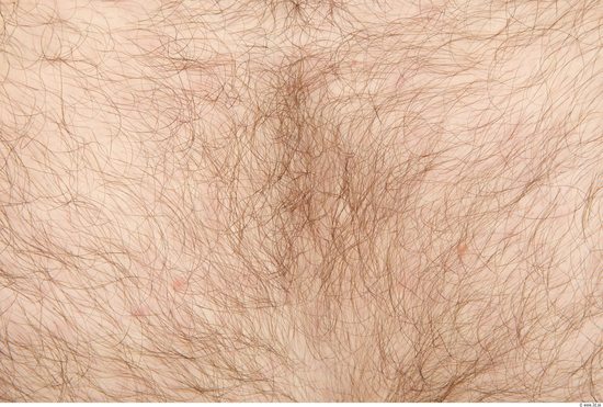 Hairy Skins