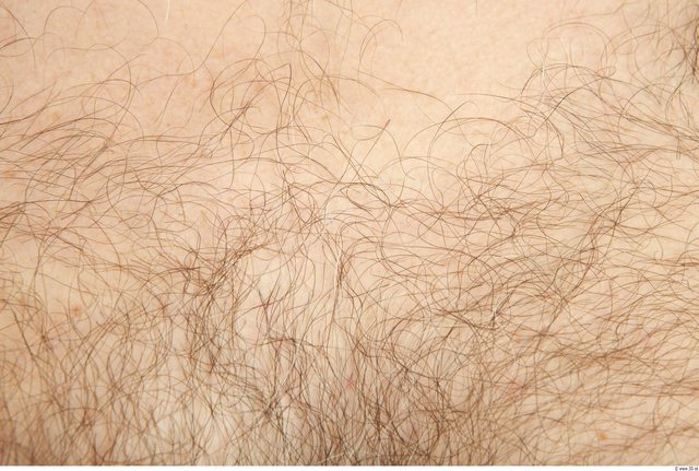 Hairy Skins