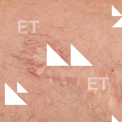 Photo Textures of Human Skin