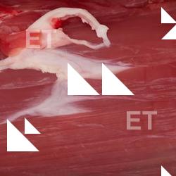 Photo Textures of RAW Beef Meat