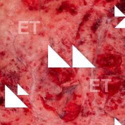 Photo Textures of RAW Pork Meat