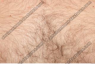 HumanSkinHairy0001