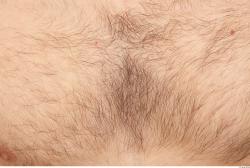 Hairy Skins