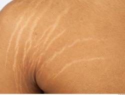 Photo Textures of Human Skin