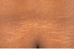 Photo Textures of Human Skin