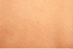 Photo Textures of Human Skin